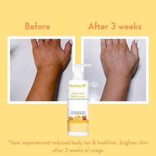WishCare Sunscreen Body Lotion SPF 50 PA+++ (200ml)