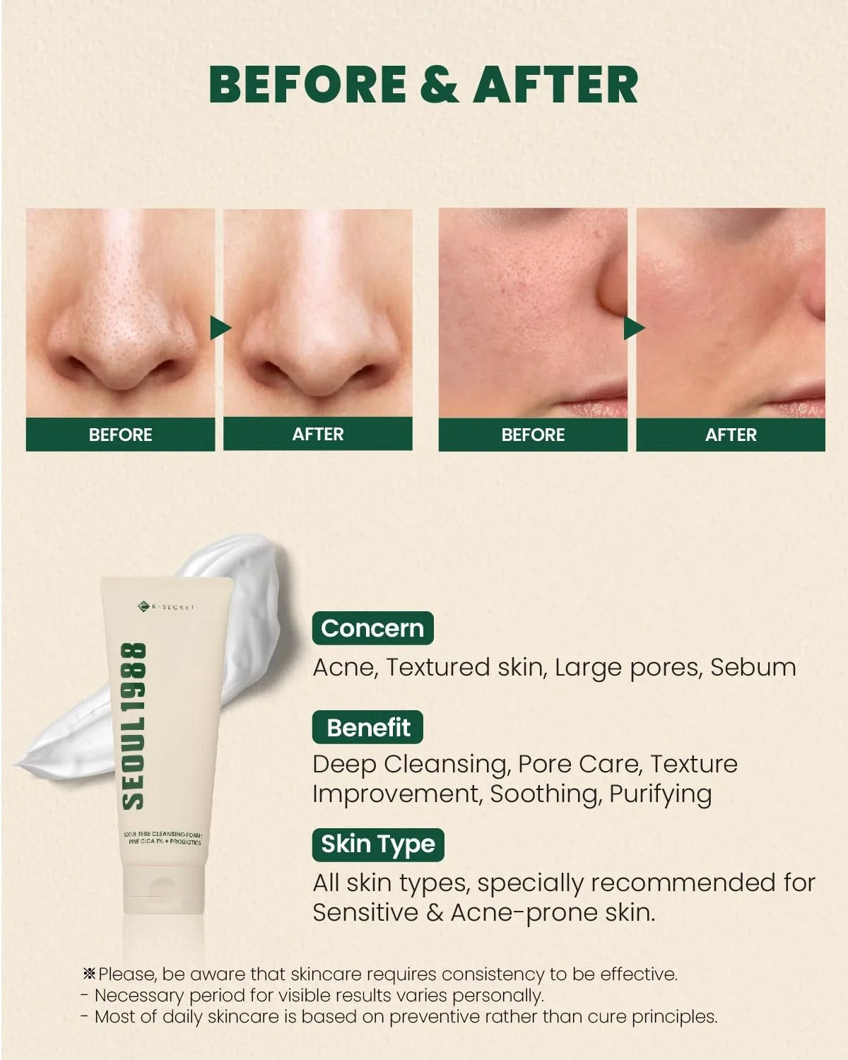 K-SECRET-SEOUL 1988 Cleansing Foam : Pine Cica 1% + Probiotics (150ml)