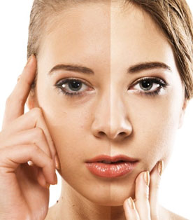 Dull Skin Treatment (Skincare)
