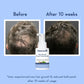 WishCare Hair Growth Serum Concentrate (30ml)