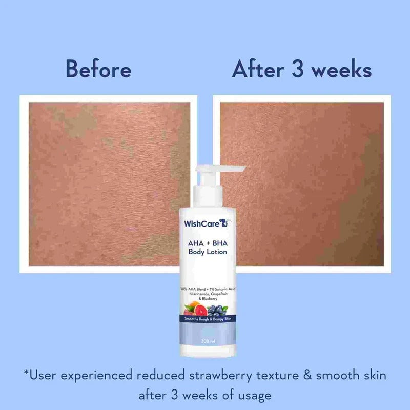 WishCare AHA + BHA Body Lotion (200ml)
