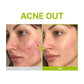 Purito Azelaic Acid 10 Kojic Tea Tree Serum 30ml