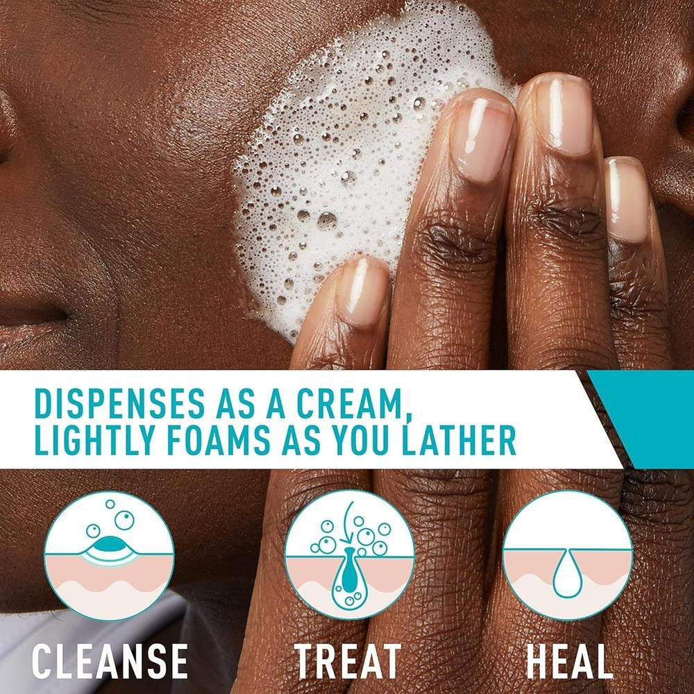 CeraVe Acne Foaming Cream Cleanser (150ml)